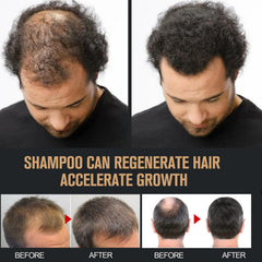 Root Activator Shampoo natural ingredients list on label, highlighting plant-based care.