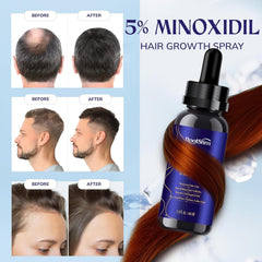 RootStim application on clean dry hair demonstrating precise use.