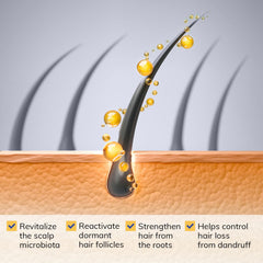 RootStim Seborrheic Dermatitis Shampoo with rosemary oil refreshes the scalp