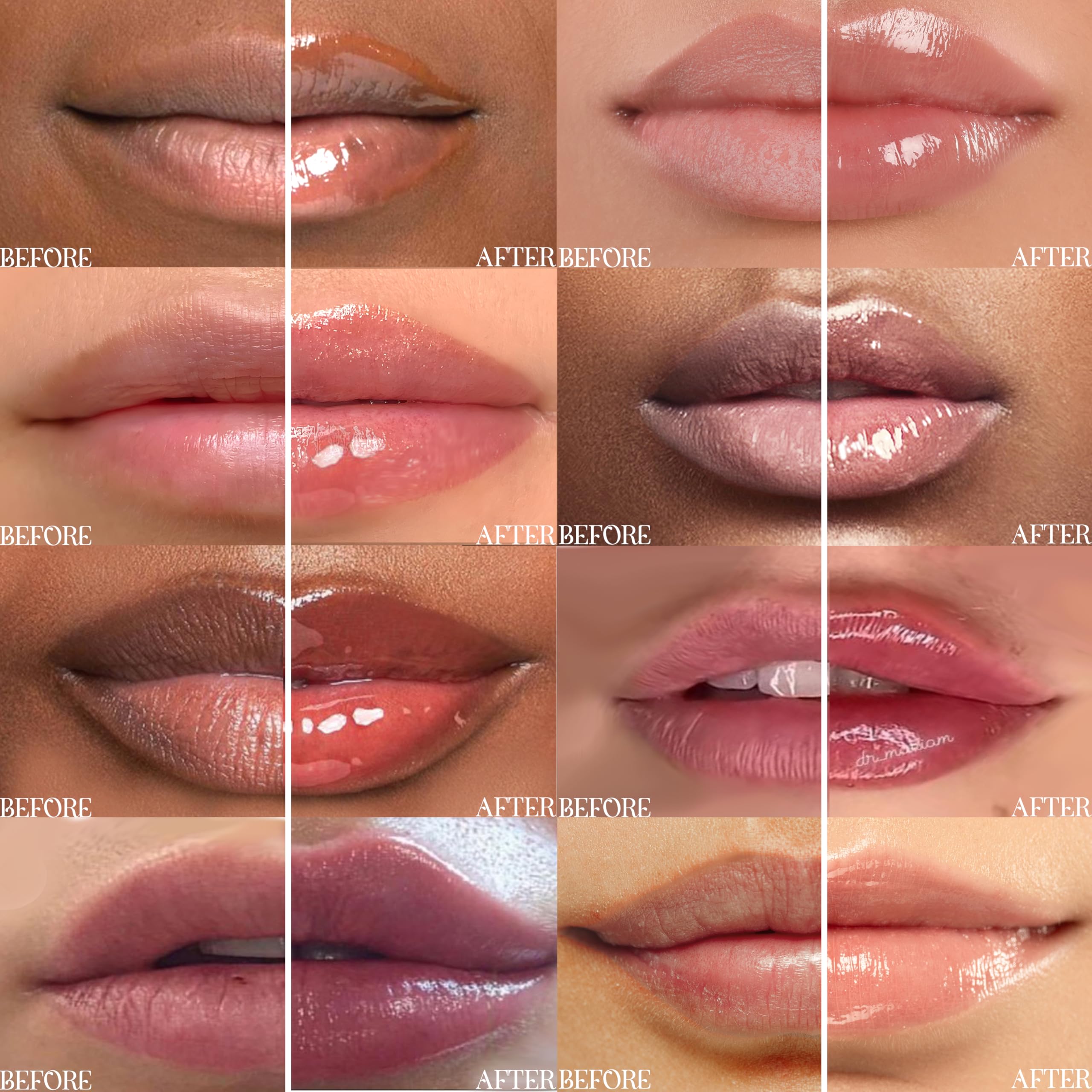 Rosee & Co Lip Gloss close-up highlights deep hydration and glossy texture