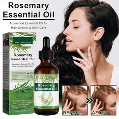 Rosemary Hair Growth Oil dropper — precise, mess-free application.