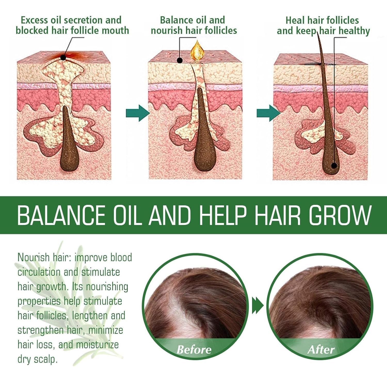 Rosemary Hair Growth Oil scalp massage — soothing application.