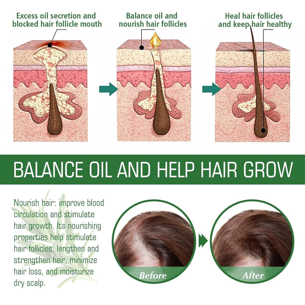 Rosemary Hair Growth Oil scalp massage — soothing application.