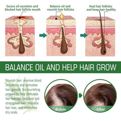 Rosemary Hair Growth Oil scalp massage — soothing application.