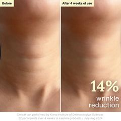 Rothea Resilience Cream neck application demonstrating smoothing and gentle hydration.