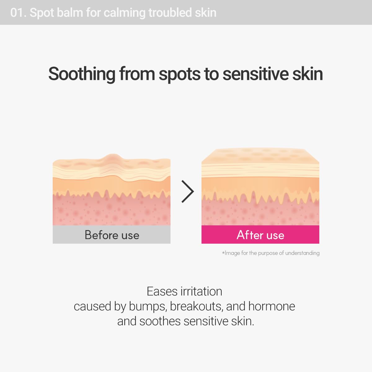 ROVECTIN Cica Care Face Balm calamine ingredient soothing redness from breakouts