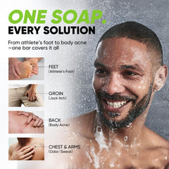 Roycederm Antifungal Soap two-bar-pack displayed for daily use and post-workout care