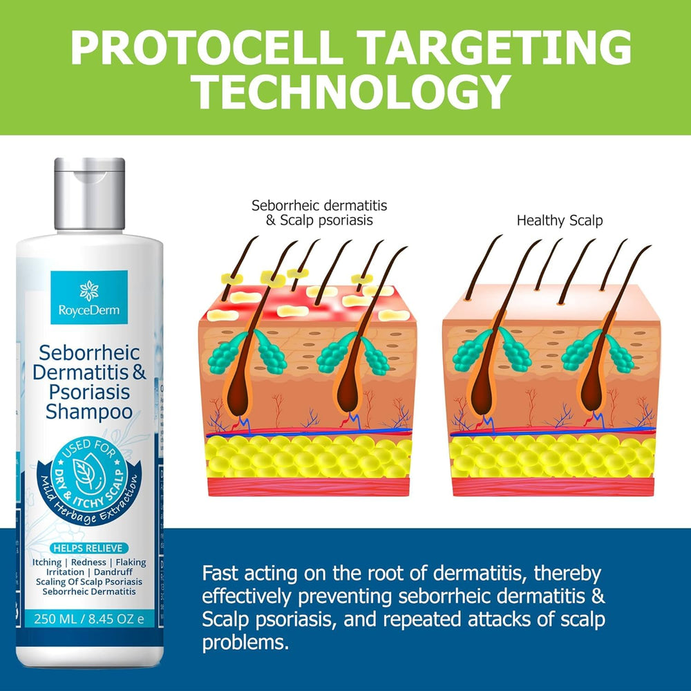 Roycederm Psoriasis Shampoo foamy lather promotes easy scalp treatment.