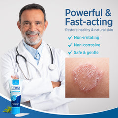 Roycederm ringworm treatment cream tube application demonstrates easy use.