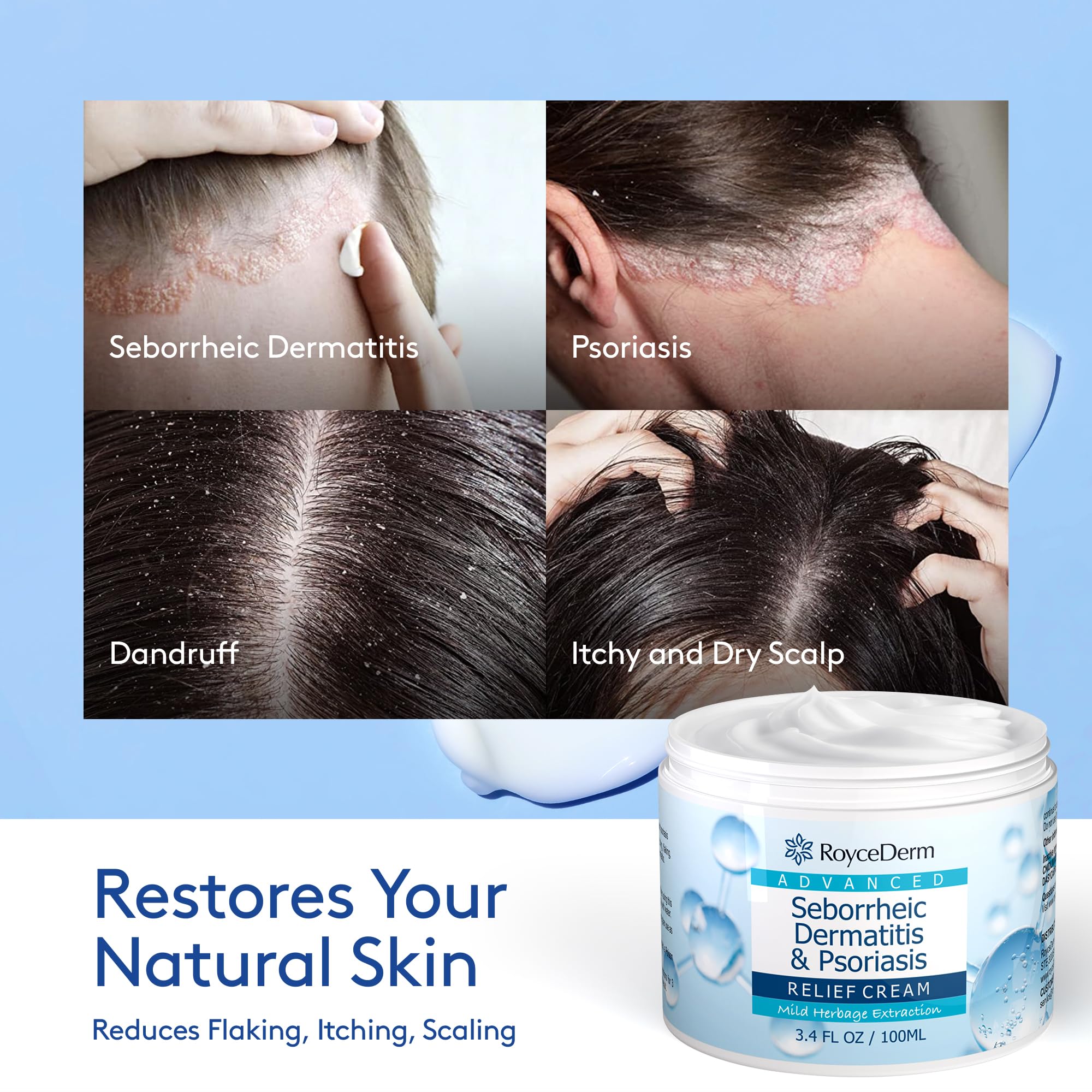 Roycederm Sebderm duo pack on display for complete scalp care routine