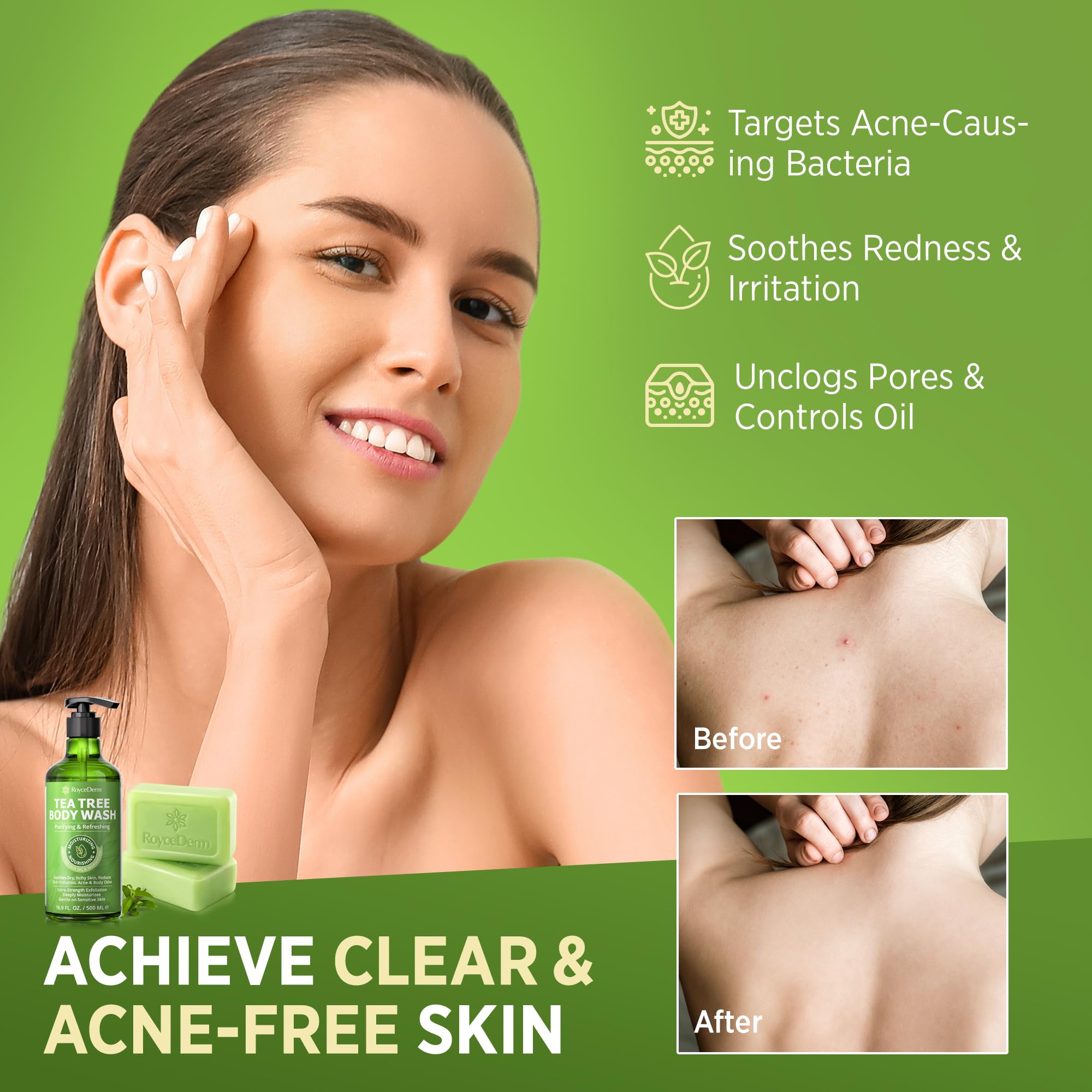 Roycederm Tea Tree Soap Bar closeup shows creamy lather and gentle cleansing.