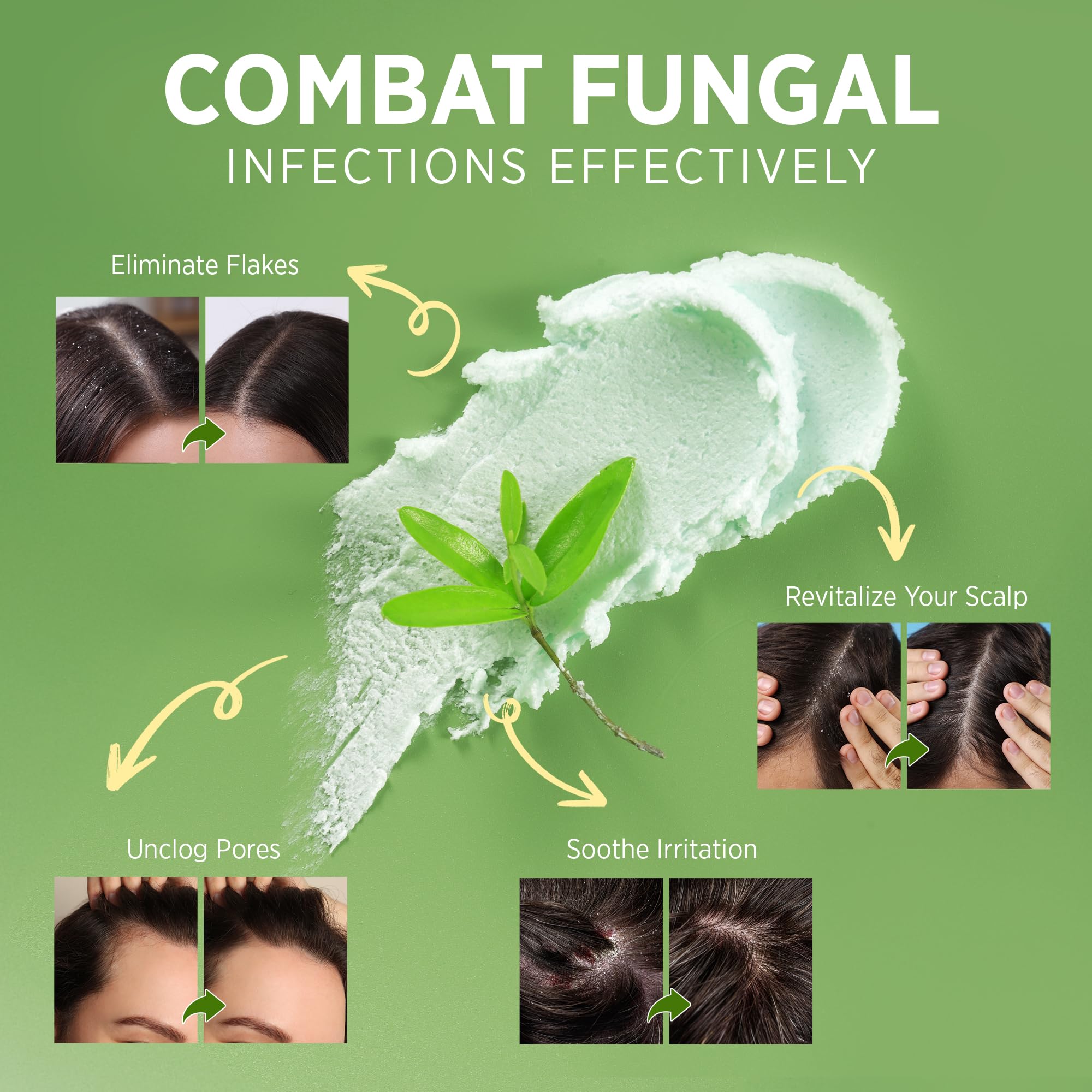Roycederm Witch Hazel component label emphasizes balancing scalp care