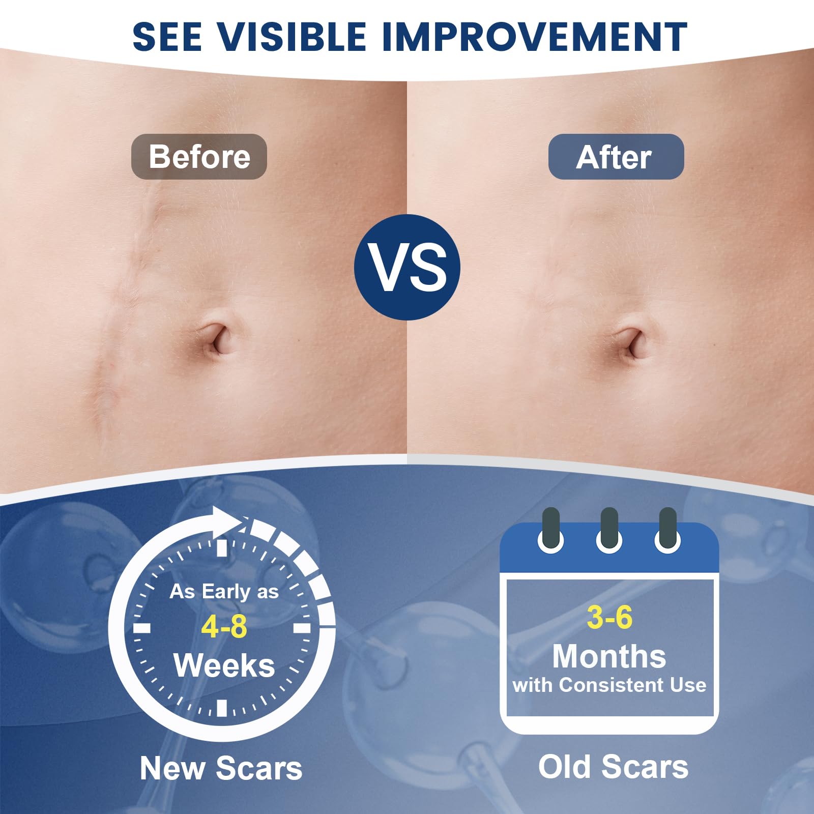 Targeted application area with Rvlaim scar care gel on skin