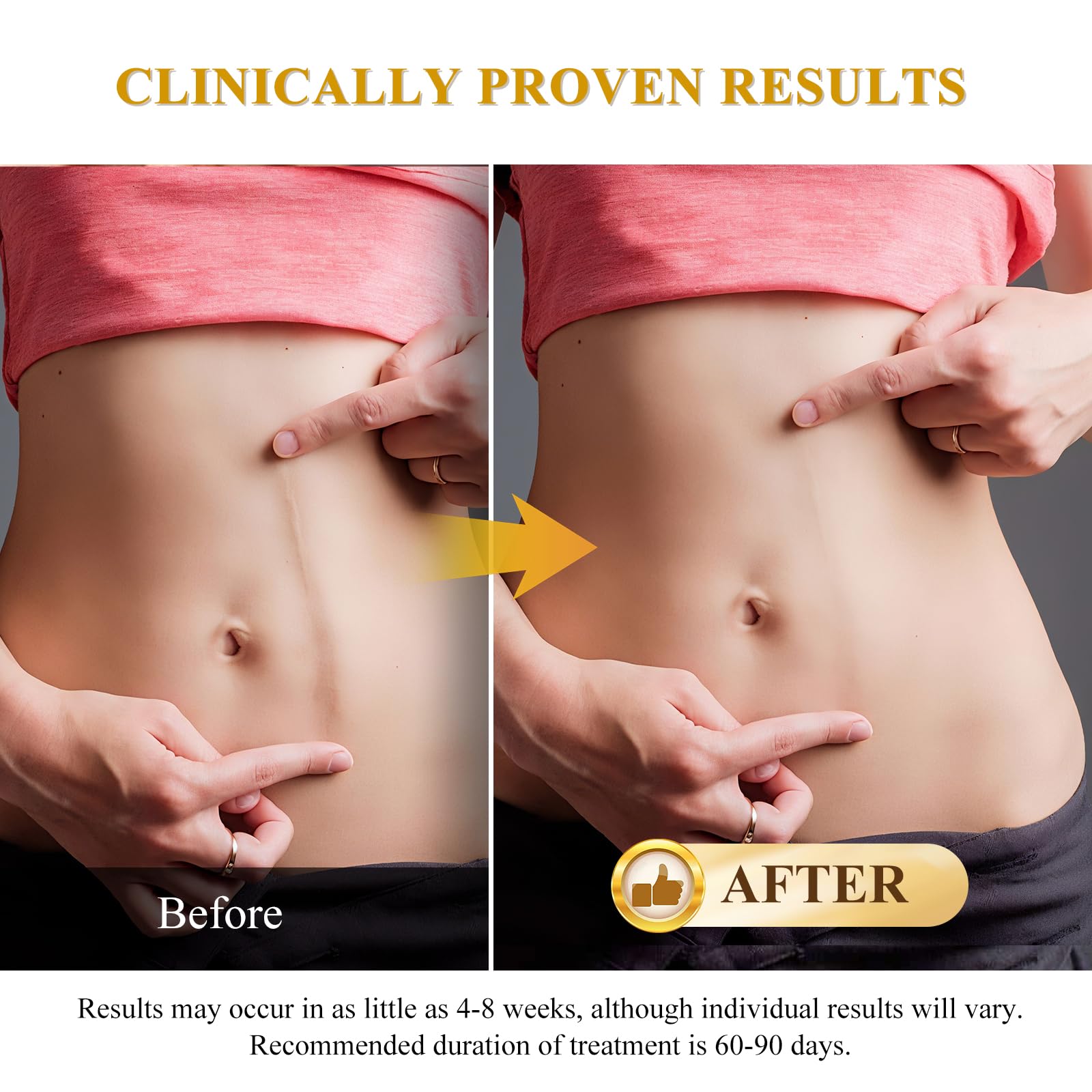 Rvlaim Scar Cream quickly absorbs for daily use.