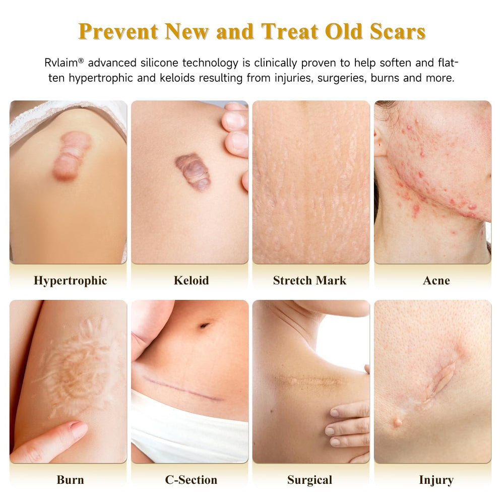 Rvlaim Scar Cream tube ready for precise, mess-free application.