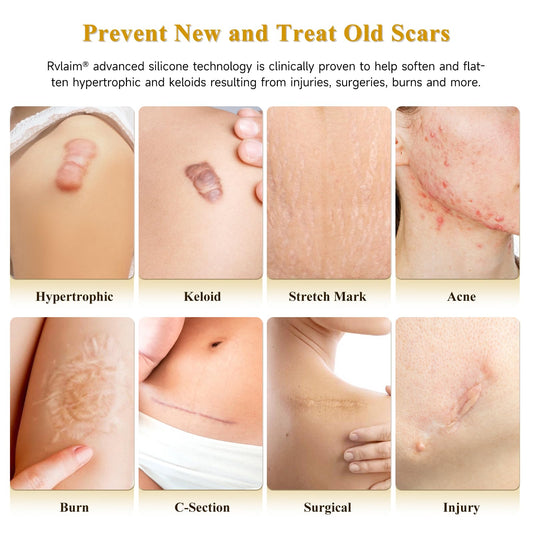 Rvlaim Scar Cream tube ready for precise, mess-free application.