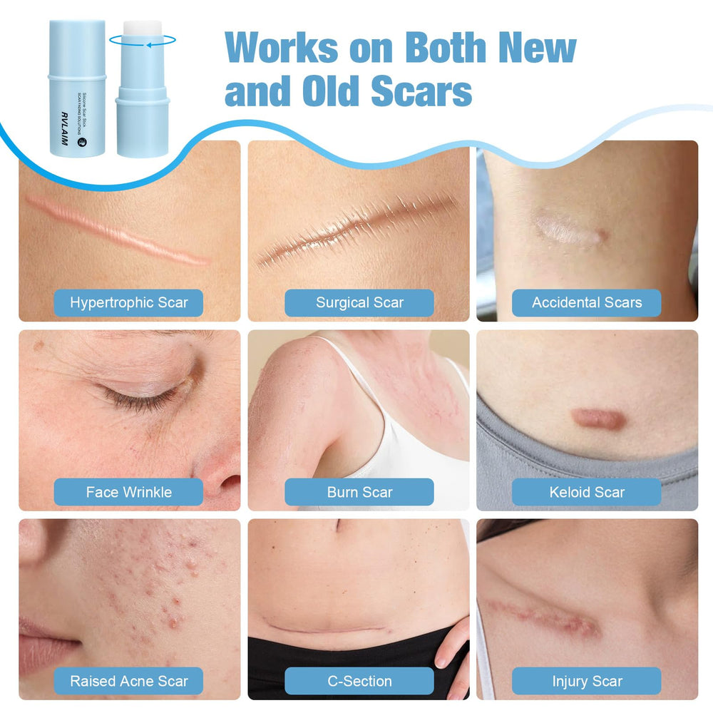 Rvlaim scar stick with Centella Asiatica extract soothing redness