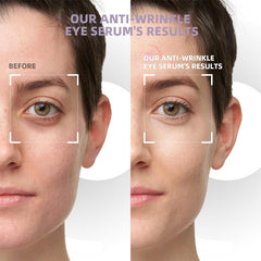 RWT Centella Niacinamide Tea Extract blend nourishes delicate under-eye skin.