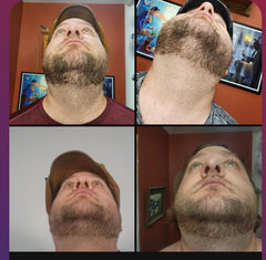 Samson's Apothecary before-after concept suggesting fuller hair look.