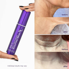SBLA duo packaging highlighting convenient routine in one kit