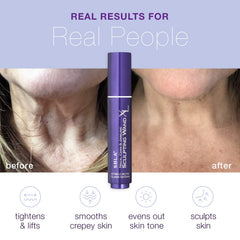 Close up of serum dispense tip for precise under chin treatment