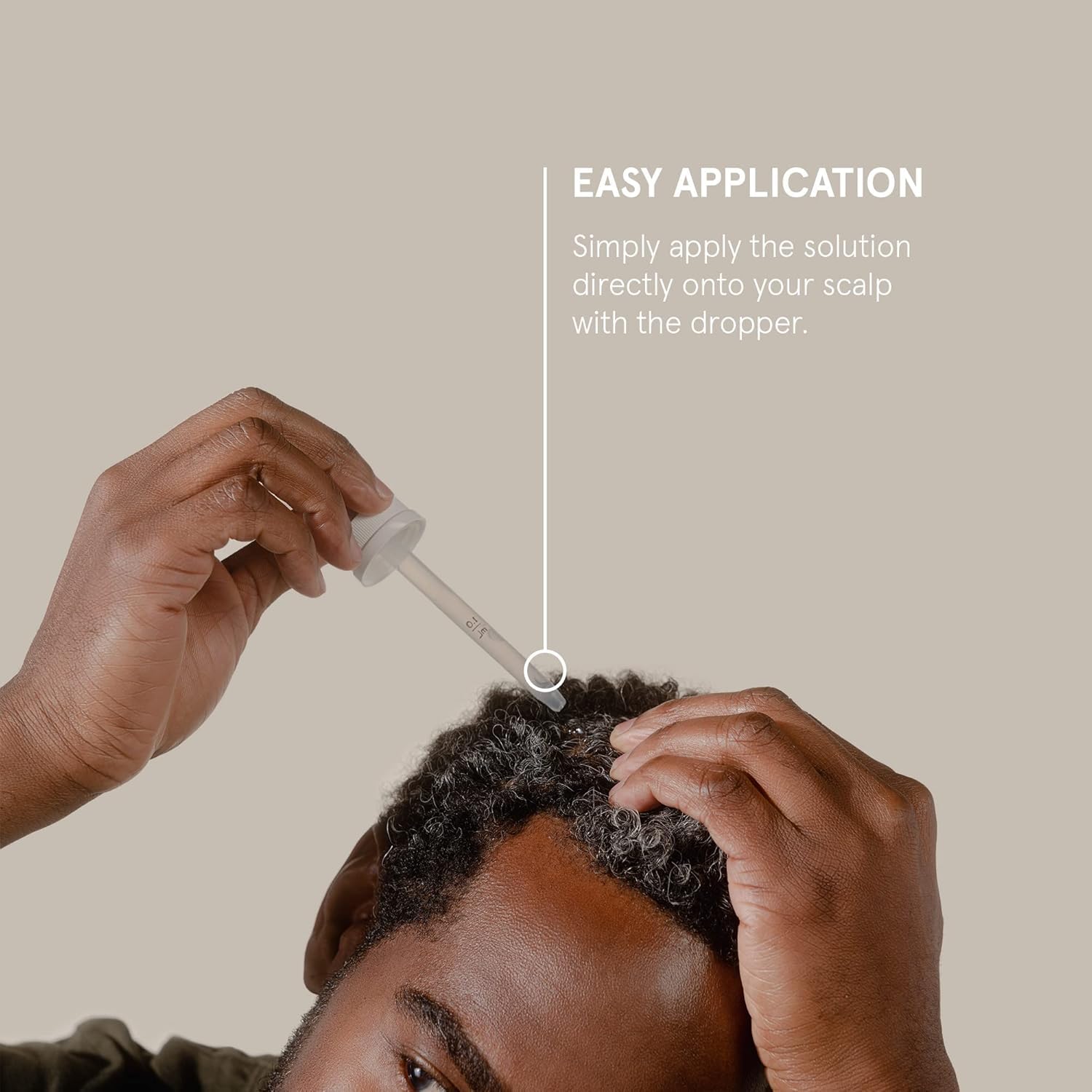 Scalp closeup showing Keeps Minoxidil application