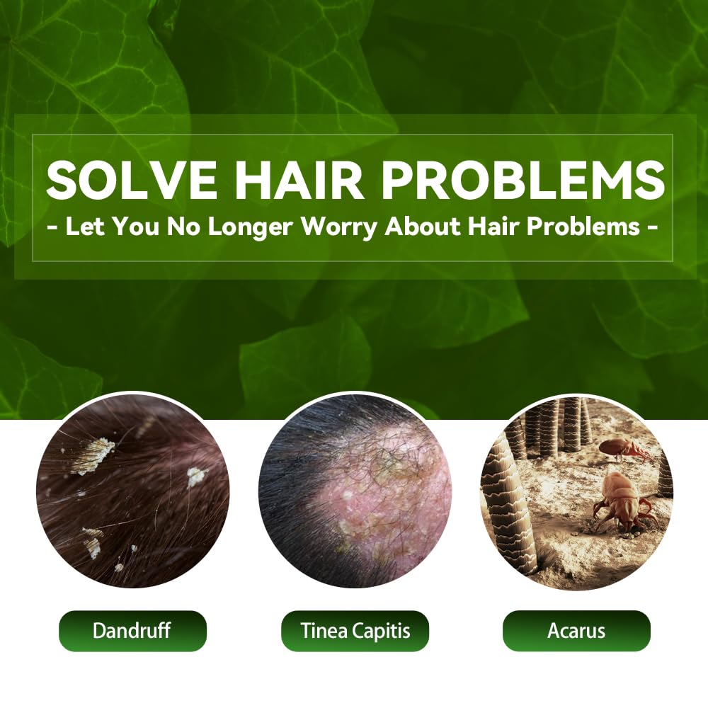 Scalp Flakes Antipruritic Shampoo on hair during cleansing to remove flakes