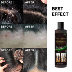 Scalp Flakes Antipruritic Shampoo rich, soothing lather during scalp massage