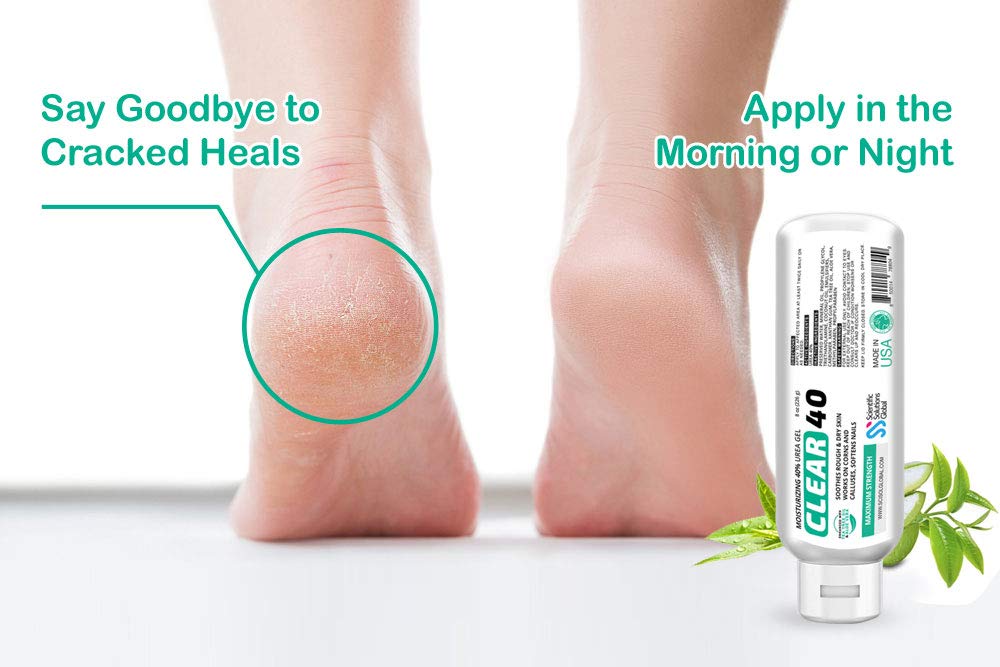 Scientific Solutions Global CLEAR 40 gel on feet softens rough skin.