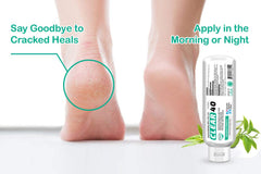Scientific Solutions Global CLEAR 40 gel on feet softens rough skin.