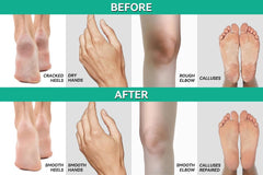 Scientific Solutions Global CLEAR 40% Urea Gel care for dry elbows and hands