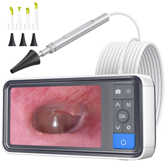 ScopeAround otoscope with 4.5-inch screen for clear ear canal viewing.