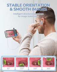 Gyroscope stabilization keeps ear canal view steady during exams.
