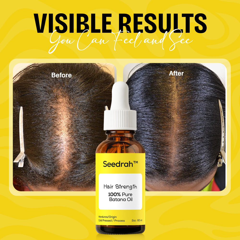 SEEDRAH Batana Oil application on hair for nourishment