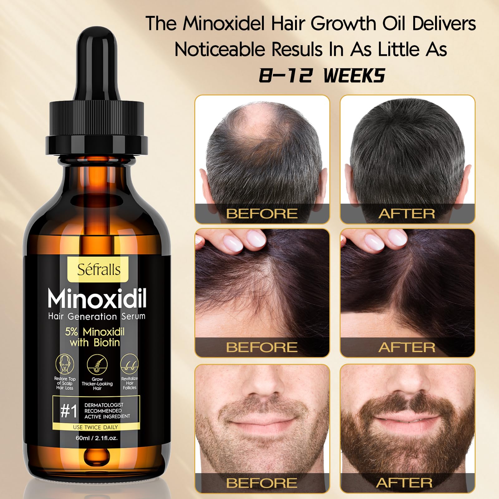 Sefralls Minoxidil oil root stimulation for healthier looking hair