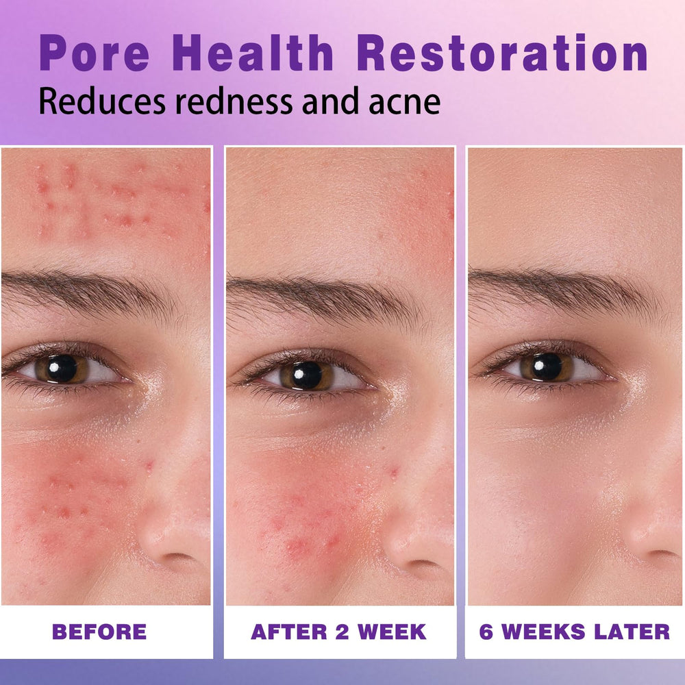 Sefralls azelaic acid cream texture detail indicates gentle exfoliation