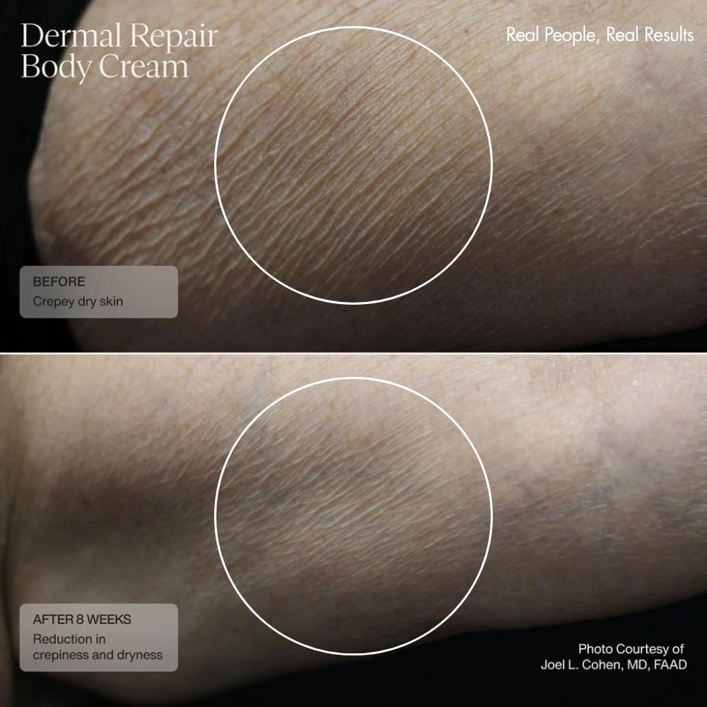 Sente Dermal Repair Body Cream close up emphasizes creamy, nourishing formula.