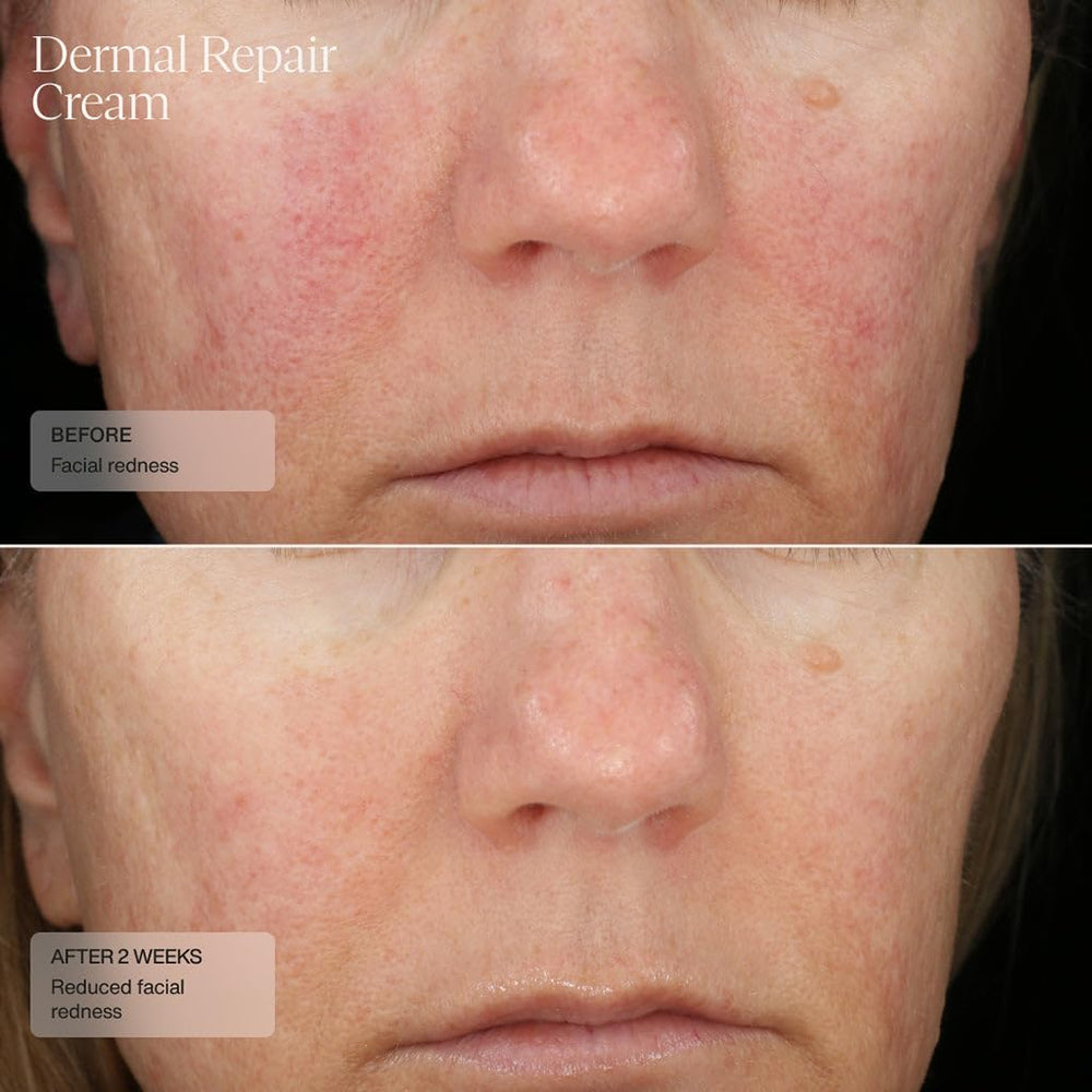 Sente Dermal Repair Cream applied to face demonstrates quick absorption and comfortable finish