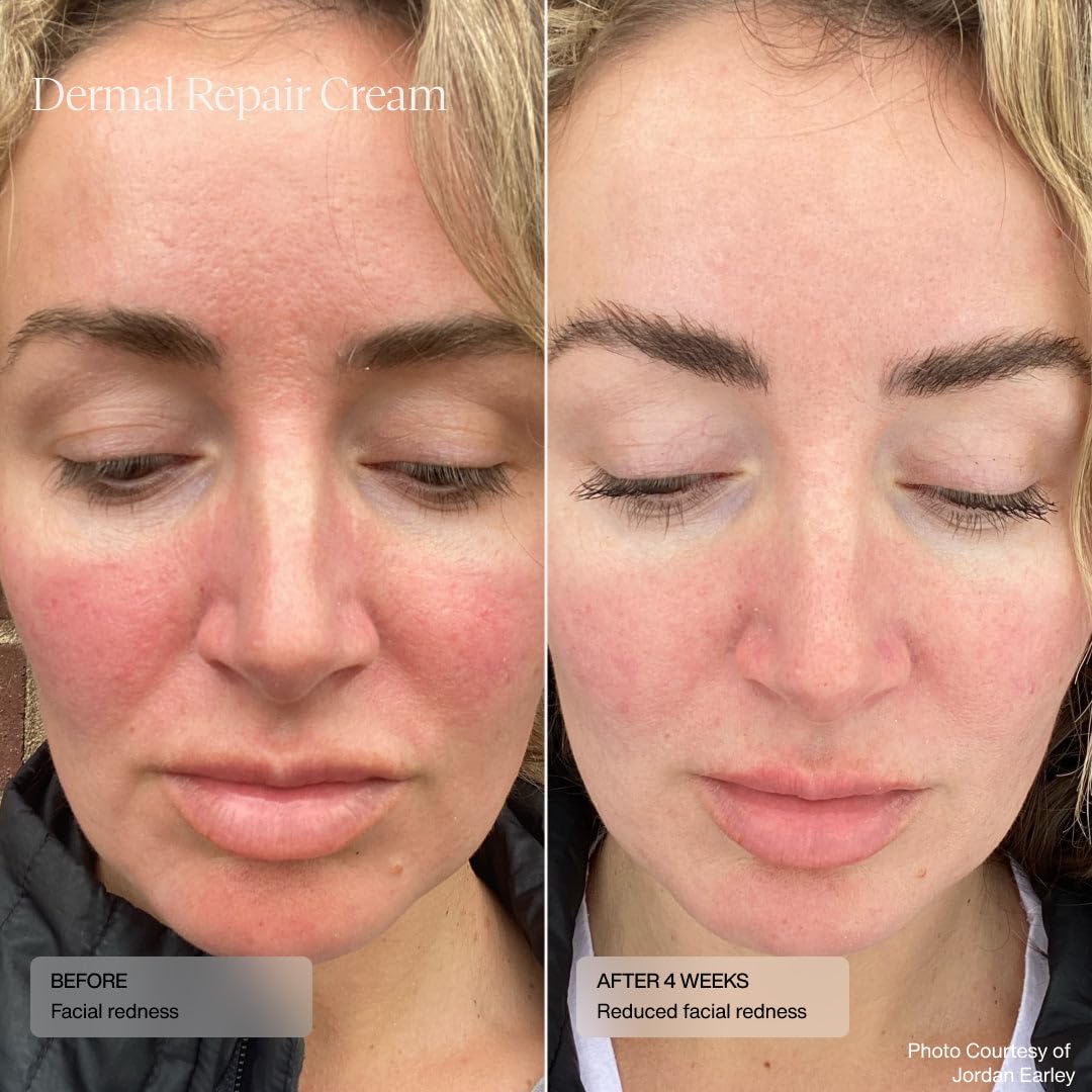 Sente Dermal Repair Cream texture close-up shows rich soothing cream for sensitive skin