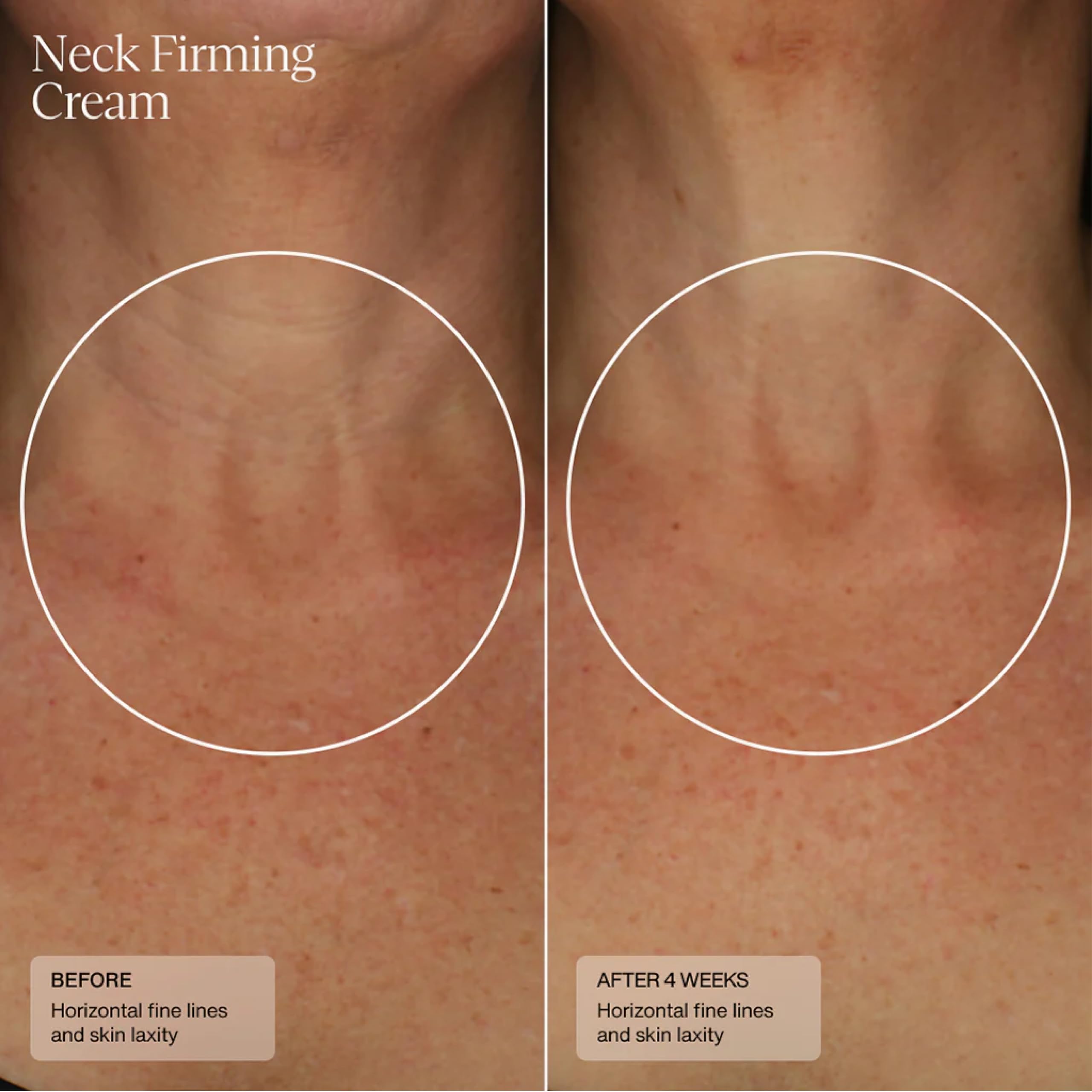 Sente HSA technology hydration concept supporting healthier-looking skin.