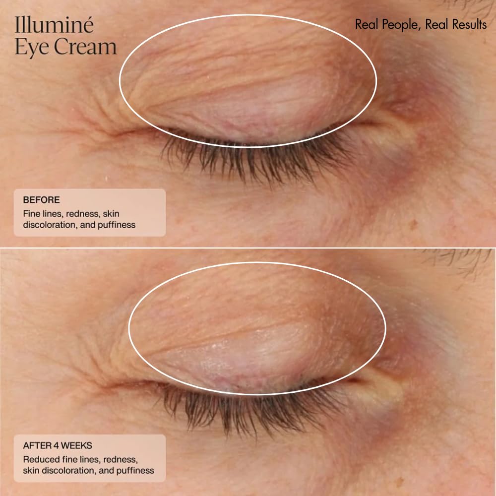 Senté Illumine Eye Cream fragrance-free formula for sensitive eyes