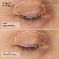 Senté Illumine Eye Cream fragrance-free formula for sensitive eyes