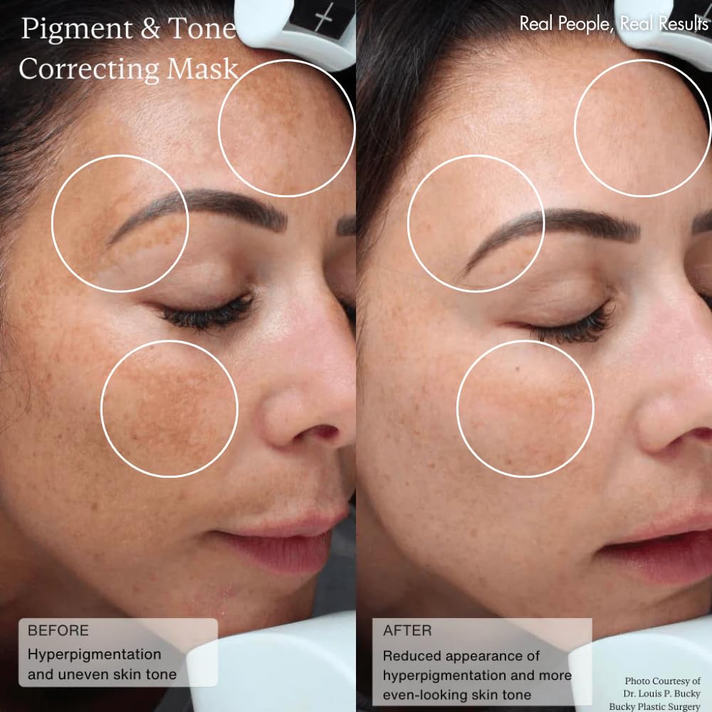 Sente skin-tone closeup highlights smoother texture and even tone.
