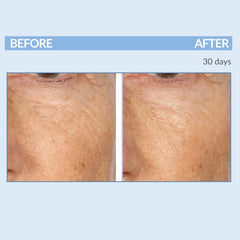 Serious Skincare A Force XR serum daily use for routine skincare