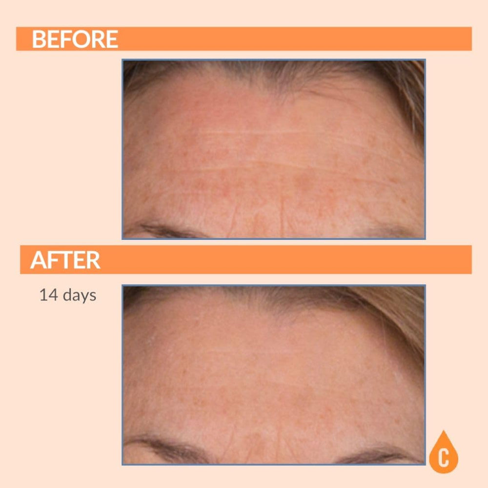 Serious Skincare hydrating Vitamin C cream close-up highlighting moisture boost