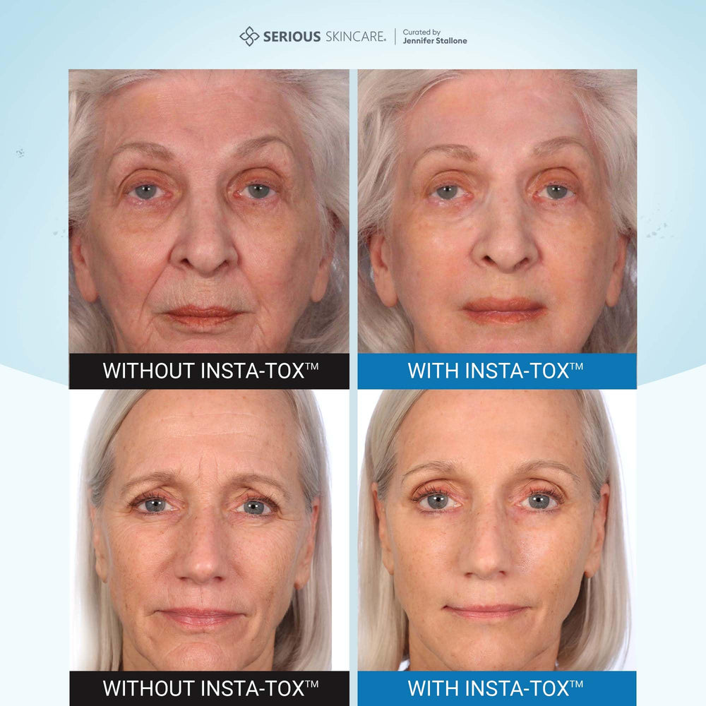 Serious Skincare INSTA-TOX application on the face demonstrates fast absorption