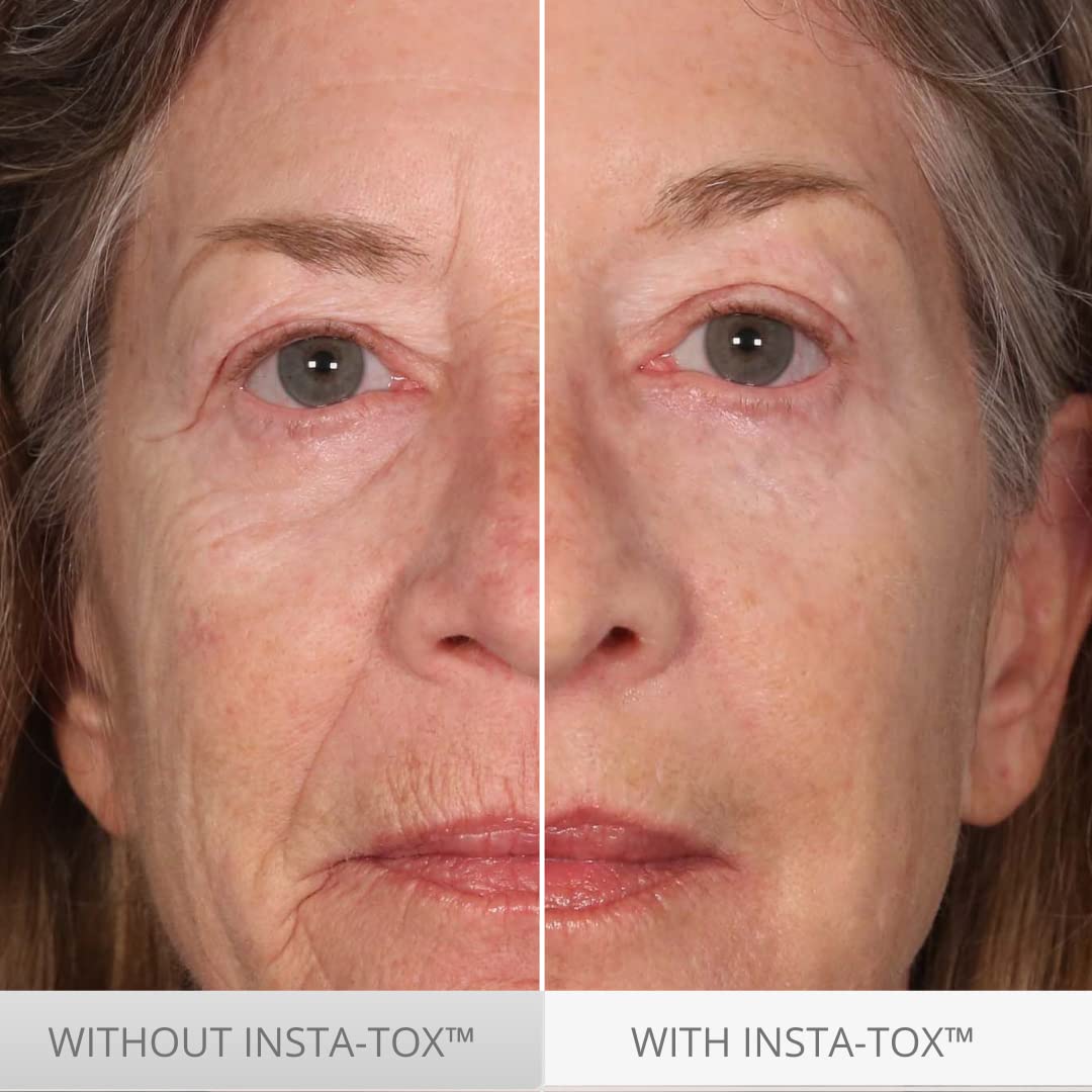 Serious Skincare INSTA-TOX drop-on-finger demonstrates quick, controlled application