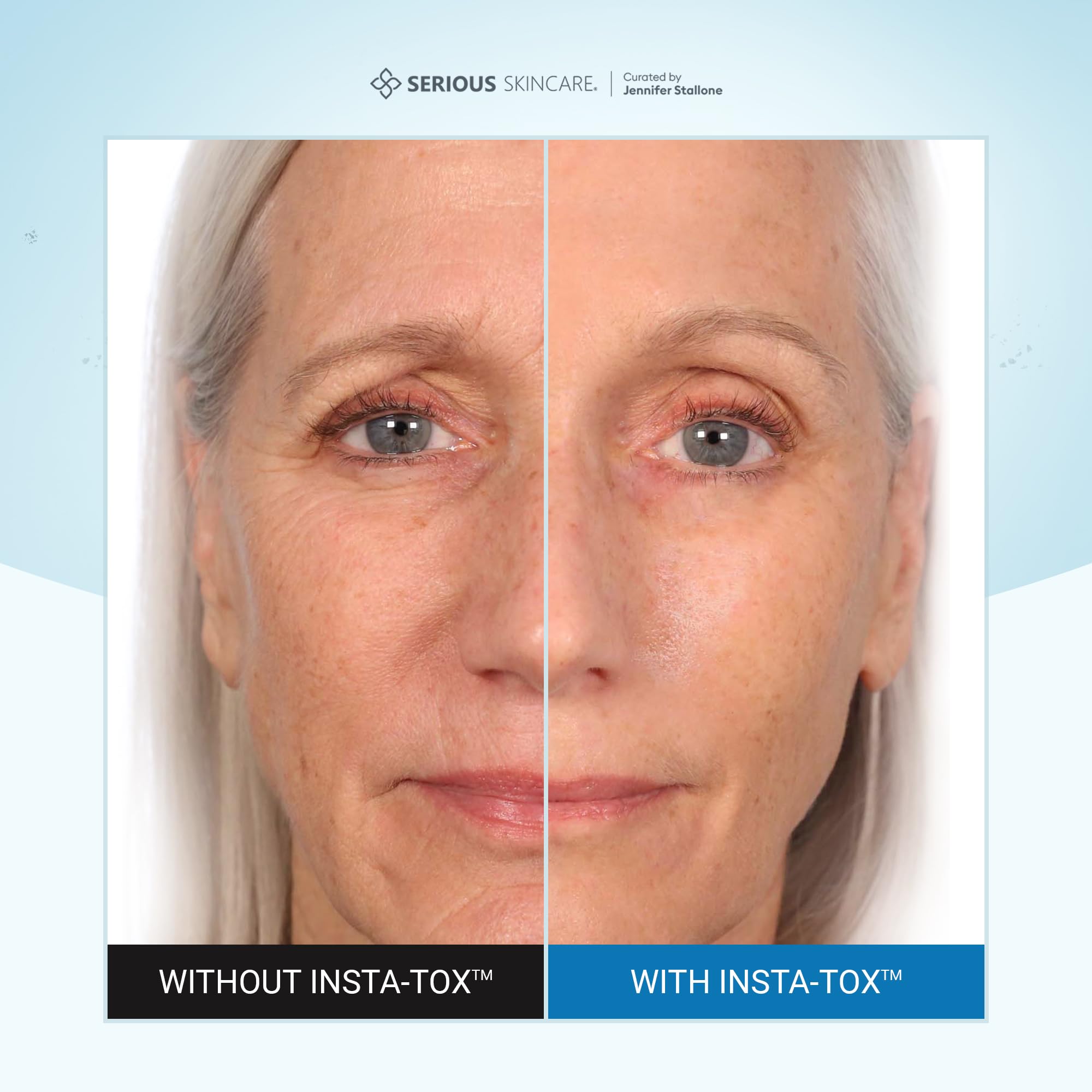 Serious Skincare INSTA-TOX eye-area application demonstrates safe area usage