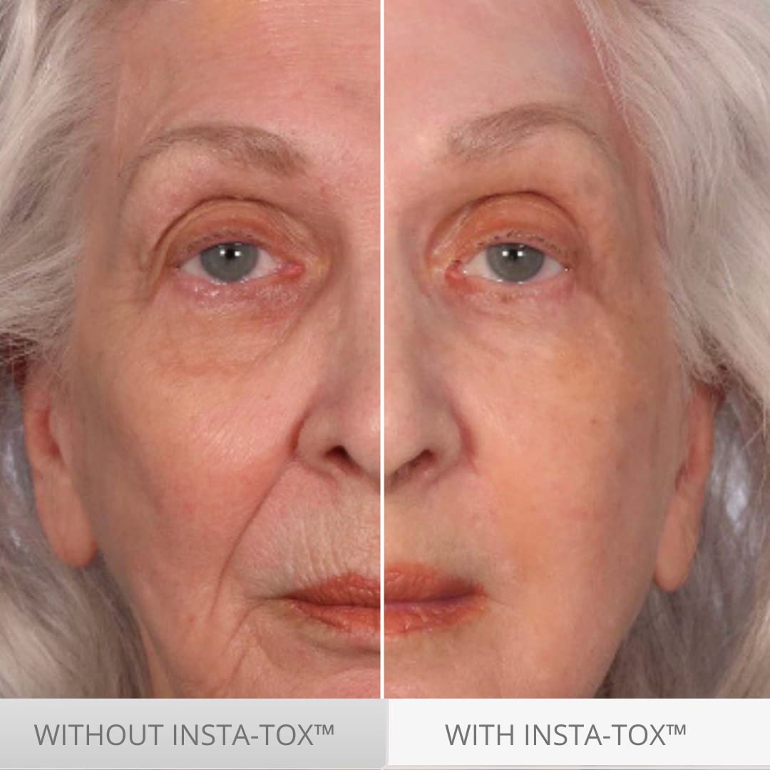 Serious Skincare INSTA-TOX gel-texture close-up shows temporary tightening for smoother skin