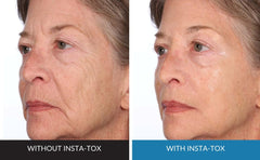 Close-up of Insta-Tox texture showing tightening feel on skin.